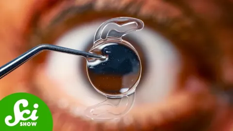 How a World War II Pilot's Eye Injury Led to the Invention of Modern Cataract Surgery