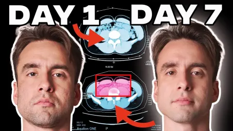 What Happened to My Body After a Seven Day Fast