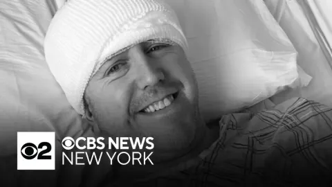 How Deep Brain Stimulation Transformed a Sports Producer's Life with Parkinson's Disease