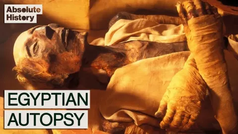 The 1976 Autopsy of Ramses II Revealed a Pharaoh in Agony