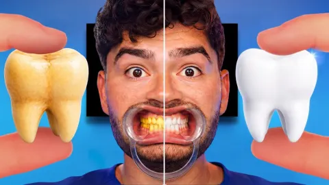 Do Viral TikTok Teeth Whitening Hacks Actually Work? We Tested Them