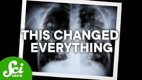 How a Breakthrough Cystic Fibrosis Drug Transformed Lives but Left Some Behind