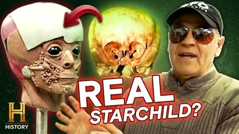 Starchild Skull and Alien Encounters: Unraveling the Mysteries of the Grays