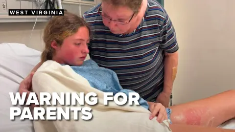 Squishy Toy Explodes in Hot Car Leaving Teen with Burns