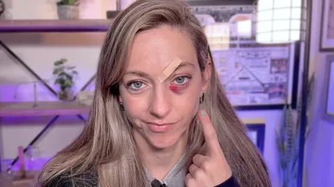 A Surfing Accident Left Me with Four Stitches and a Black Eye