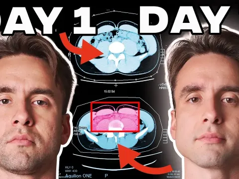 What Happened to My Body After a Seven Day Fast