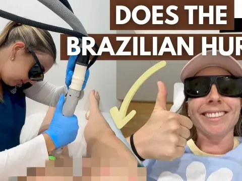 My First Laser Hair Removal Experience in Sydney: What to Expect