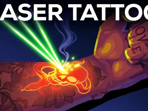 How Laser Tattoo Removal Works and Why It's Painful