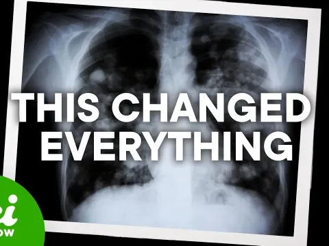How a Breakthrough Cystic Fibrosis Drug Transformed Lives but Left Some Behind