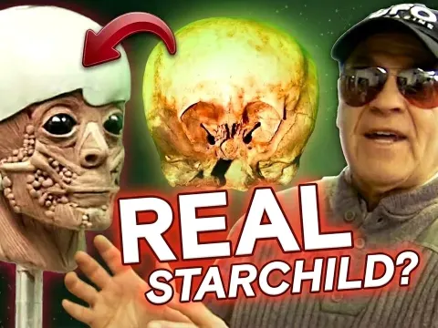 Starchild Skull and Alien Encounters: Unraveling the Mysteries of the Grays