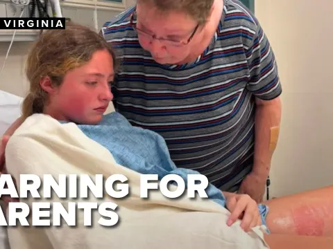 Squishy Toy Explodes in Hot Car Leaving Teen with Burns