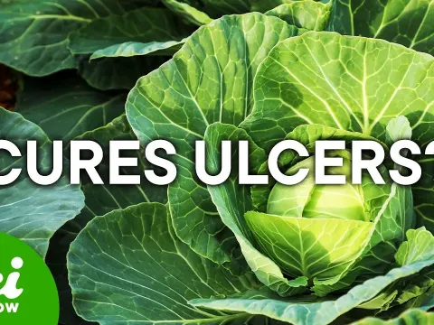 How Cabbage Became an Unlikely Treatment for Ulcers in the 20th Century