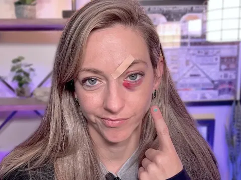 A Surfing Accident Left Me with Four Stitches and a Black Eye